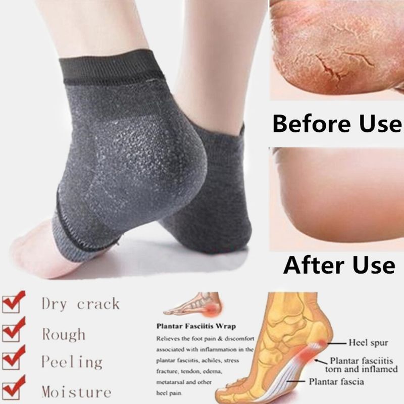 10 Paar Silikon-antiriss-socken Fußpflege Rissiger Fuß Trockene Harte Haut Schutz Feuchtigkeitsspendende Spa-gel-socken